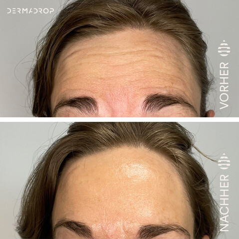 Dermadrop-Tda-Skin-Effect-Fachinstitut-Kathrin-Maegerlein